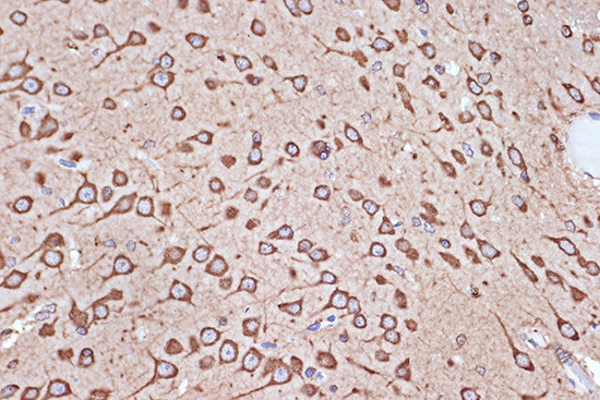 EEF1G Antibody in Immunohistochemistry (Paraffin) (IHC (P))