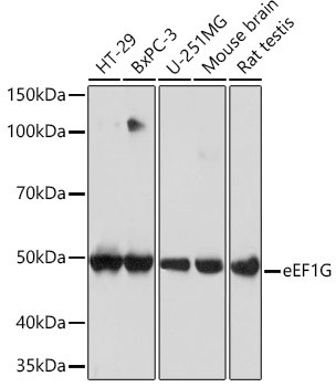 EEF1G Antibody in Western Blot (WB)