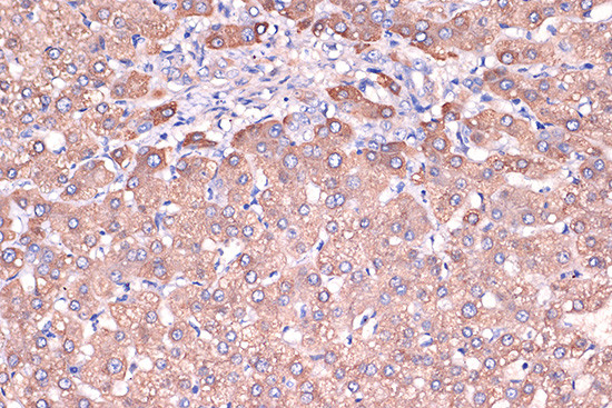 Haptoglobin Antibody in Immunohistochemistry (Paraffin) (IHC (P))