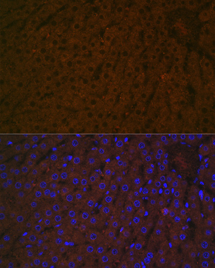 Haptoglobin Antibody in Immunohistochemistry (Paraffin) (IHC (P))