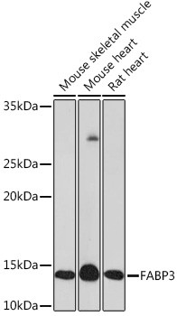 FABP3 Antibody in Western Blot (WB)