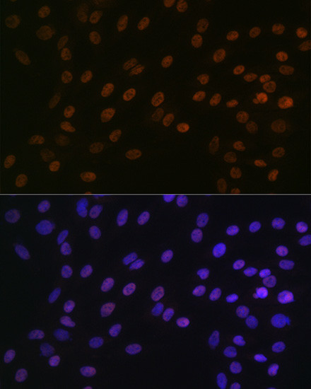 Bub3 Antibody in Immunocytochemistry (ICC/IF)