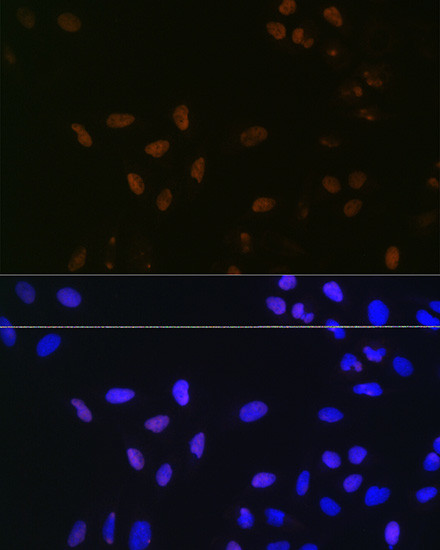 Bub3 Antibody in Immunocytochemistry (ICC/IF)