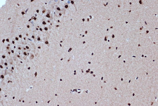 Bub3 Antibody in Immunohistochemistry (Paraffin) (IHC (P))