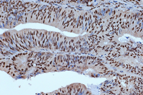 Bub3 Antibody in Immunohistochemistry (Paraffin) (IHC (P))