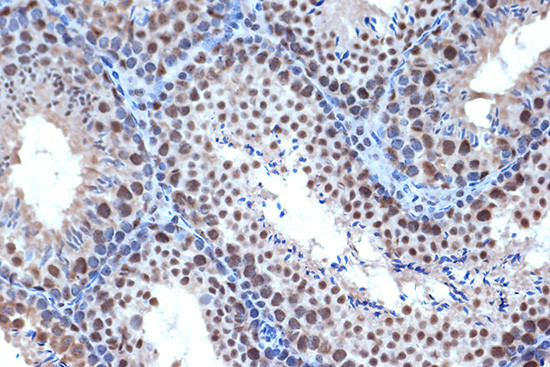 Bub3 Antibody in Immunohistochemistry (Paraffin) (IHC (P))