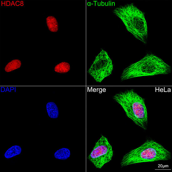 HDAC8 Antibody in Immunocytochemistry (ICC/IF)