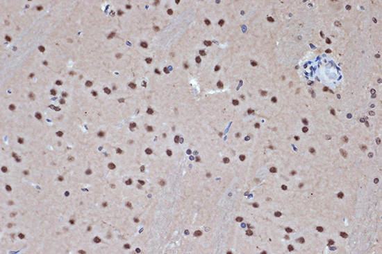 HDAC8 Antibody in Immunohistochemistry (Paraffin) (IHC (P))