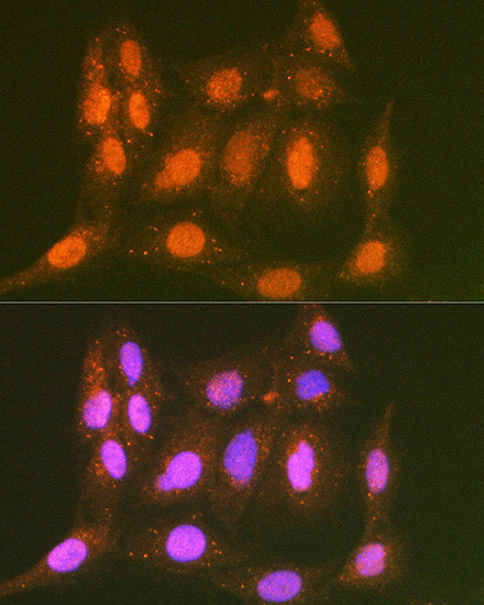 LTA4H Antibody in Immunocytochemistry (ICC/IF)