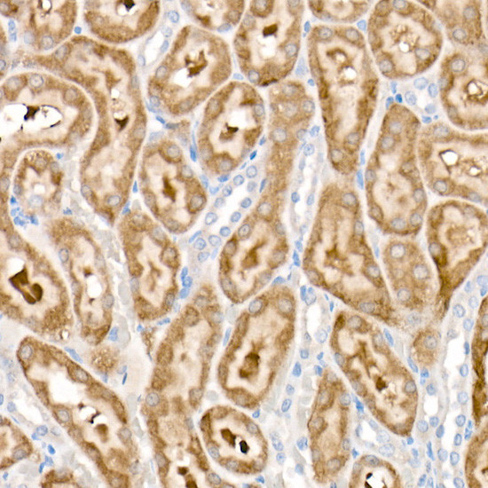 PDK1 Antibody in Immunohistochemistry (Paraffin) (IHC (P))