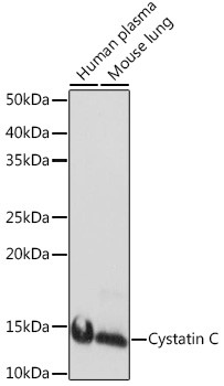 Cystatin C Antibody in Western Blot (WB)