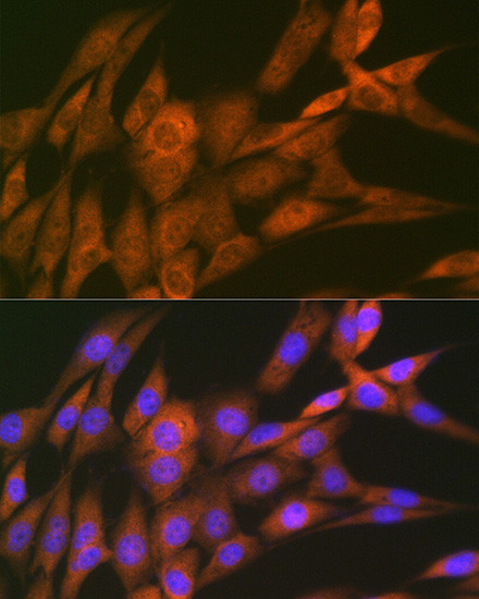 14-3-3 theta Antibody in Immunocytochemistry (ICC/IF)