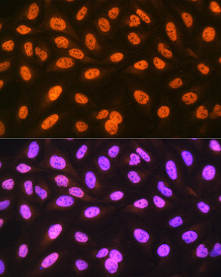 hnRNP C Antibody in Immunocytochemistry (ICC/IF)