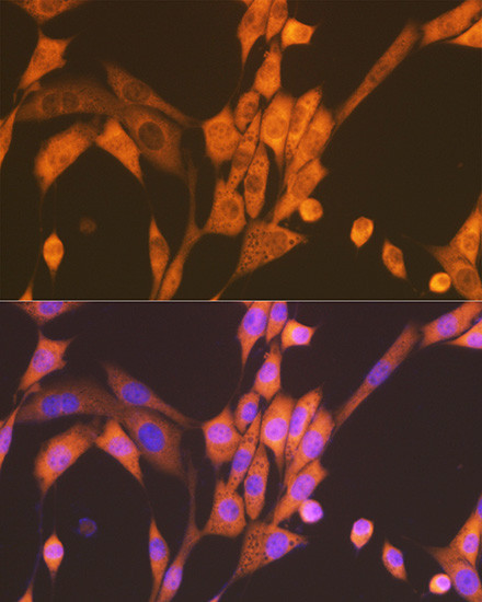 Raptor Antibody in Immunocytochemistry (ICC/IF)