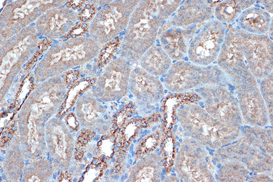 Raptor Antibody in Immunohistochemistry (Paraffin) (IHC (P))