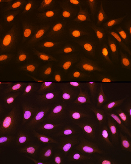 Histone Macro-H2A.1 Antibody in Immunocytochemistry (ICC/IF)