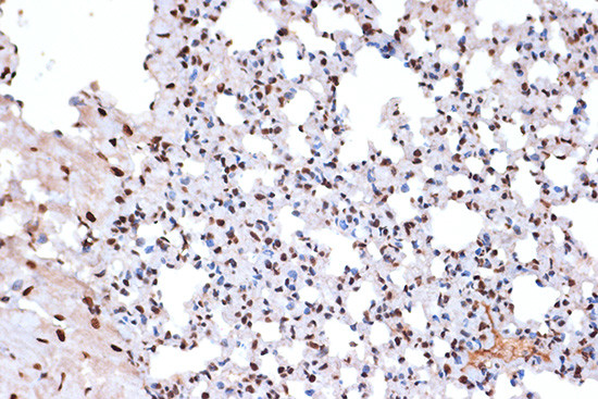 Histone Macro-H2A.1 Antibody in Immunohistochemistry (Paraffin) (IHC (P))