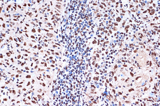 KHSRP Antibody in Immunohistochemistry (Paraffin) (IHC (P))