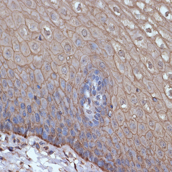 TMPRSS2 Antibody in Immunohistochemistry (Paraffin) (IHC (P))