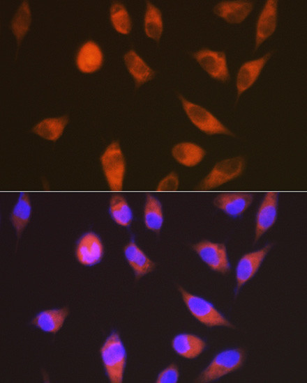 LGR6 Antibody in Immunocytochemistry (ICC/IF)