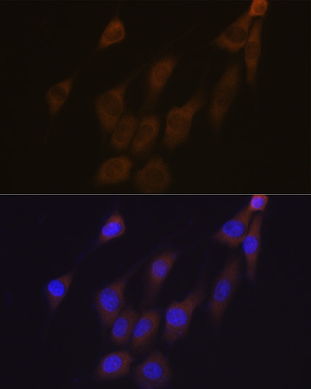 PRDX4 Antibody in Immunocytochemistry (ICC/IF)