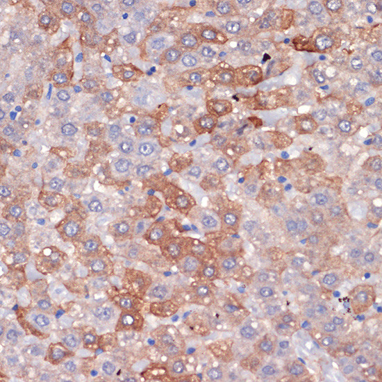 Hemopexin Antibody in Immunohistochemistry (Paraffin) (IHC (P))