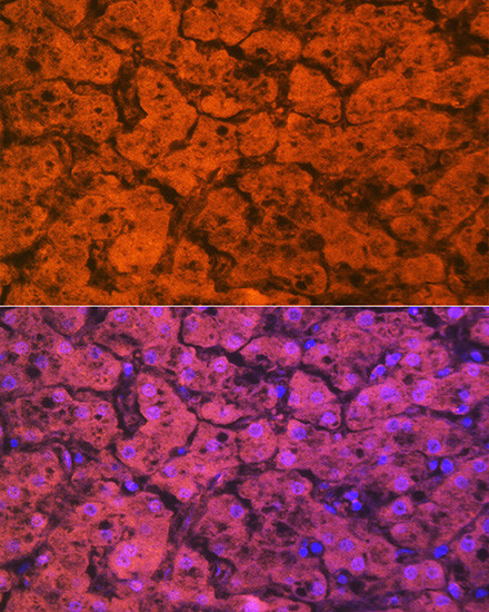 Hemopexin Antibody in Immunohistochemistry (Paraffin) (IHC (P))