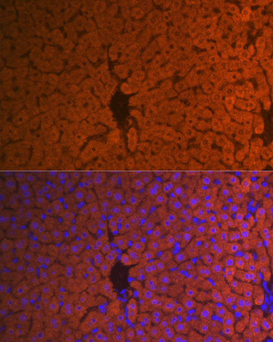 Hemopexin Antibody in Immunohistochemistry (Paraffin) (IHC (P))