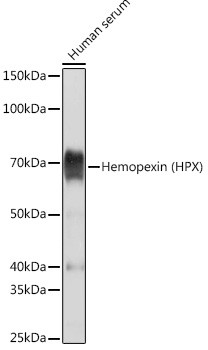 Hemopexin Antibody in Western Blot (WB)