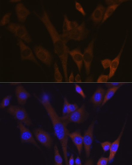 ABCE1 Antibody in Immunocytochemistry (ICC/IF)