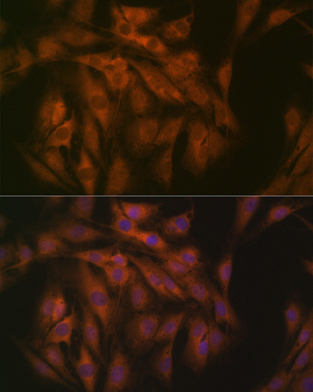 eIF3b Antibody in Immunocytochemistry (ICC/IF)