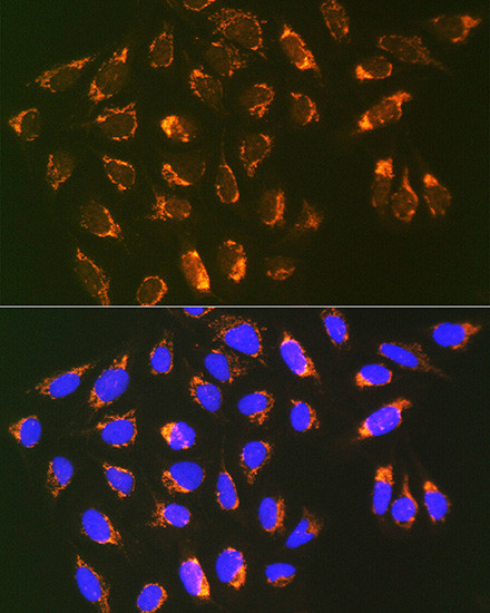 REA Antibody in Immunocytochemistry (ICC/IF)