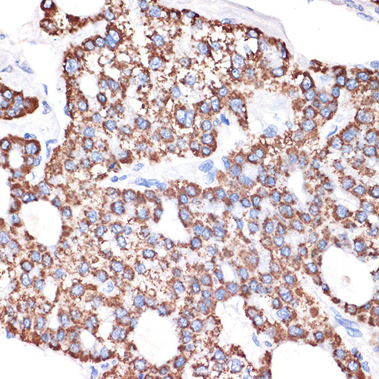 ABAT Antibody in Immunohistochemistry (Paraffin) (IHC (P))