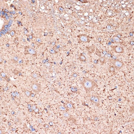 ABAT Antibody in Immunohistochemistry (Paraffin) (IHC (P))