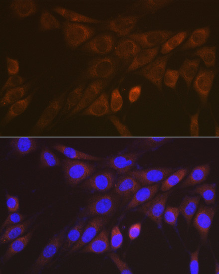 14-3-3 beta/zeta Antibody in Immunocytochemistry (ICC/IF)