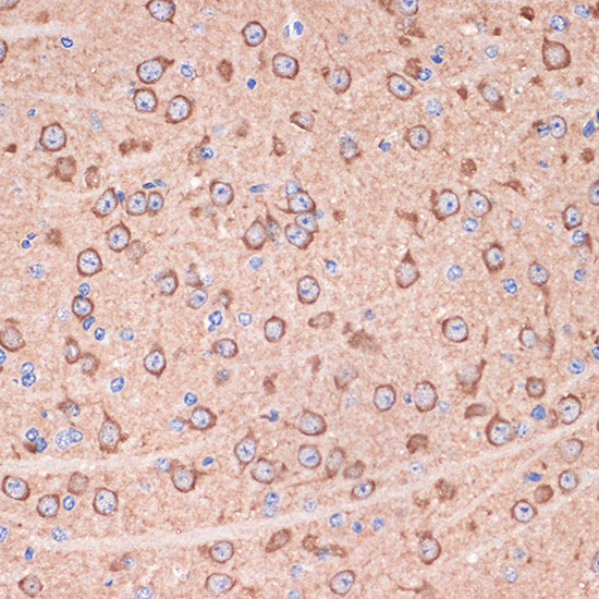 14-3-3 gamma Antibody in Immunohistochemistry (Paraffin) (IHC (P))