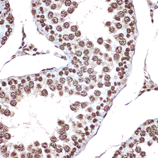 HMGB2 Antibody in Immunohistochemistry (Paraffin) (IHC (P))