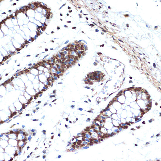 HMGB2 Antibody in Immunohistochemistry (Paraffin) (IHC (P))