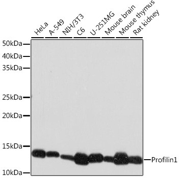 Profilin 1 Antibody in Western Blot (WB)