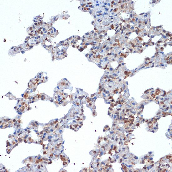 SOCS2 Antibody in Immunohistochemistry (Paraffin) (IHC (P))