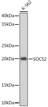 SOCS2 Antibody in Western Blot (WB)