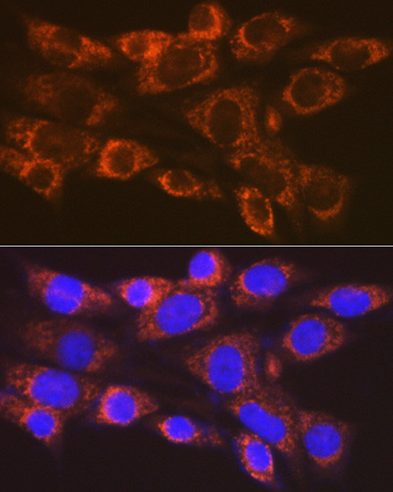 ARF1 Antibody in Immunocytochemistry (ICC/IF)