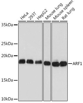 ARF1 Antibody in Western Blot (WB)