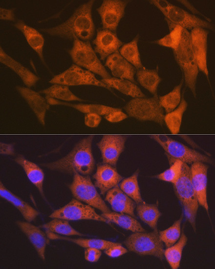 CaMKII delta Antibody in Immunocytochemistry (ICC/IF)