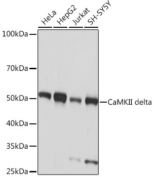 CaMKII delta Antibody in Western Blot (WB)