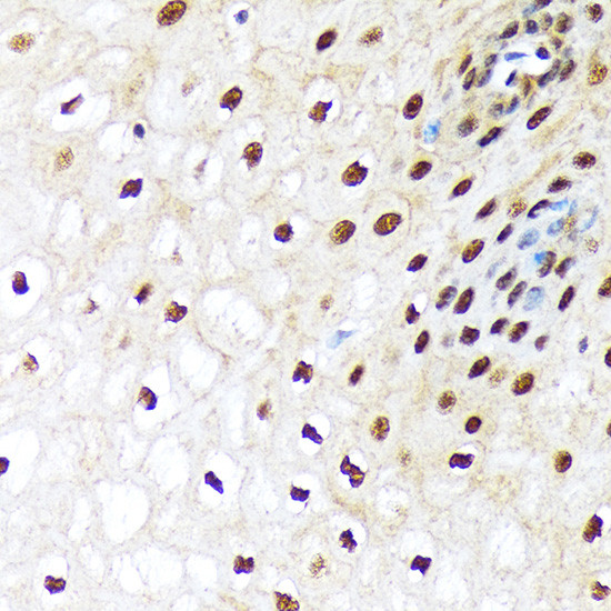 UBE1 Antibody in Immunohistochemistry (Paraffin) (IHC (P))