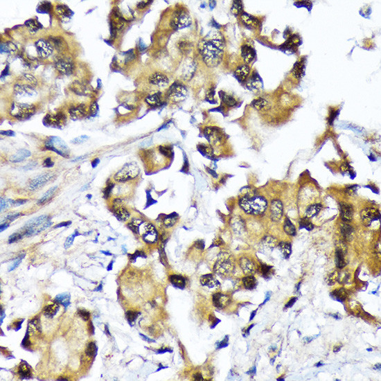 UBC13 Antibody in Immunohistochemistry (Paraffin) (IHC (P))