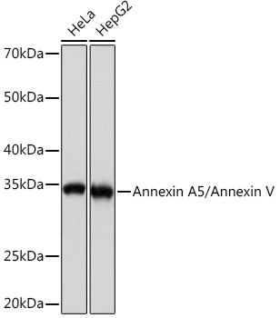 Annexin V Antibody in Western Blot (WB)