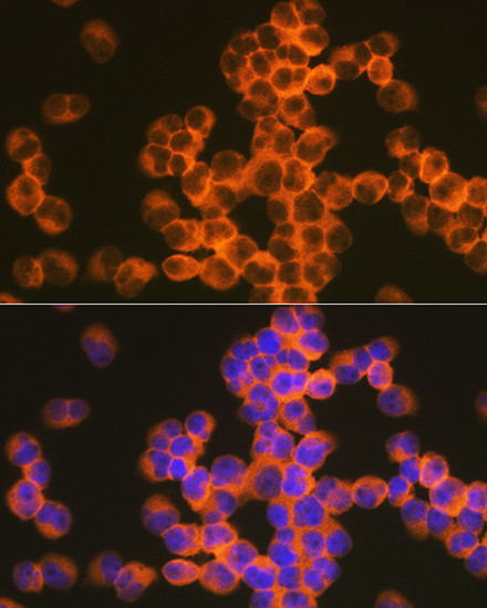 CD82 Antibody in Immunocytochemistry (ICC/IF)