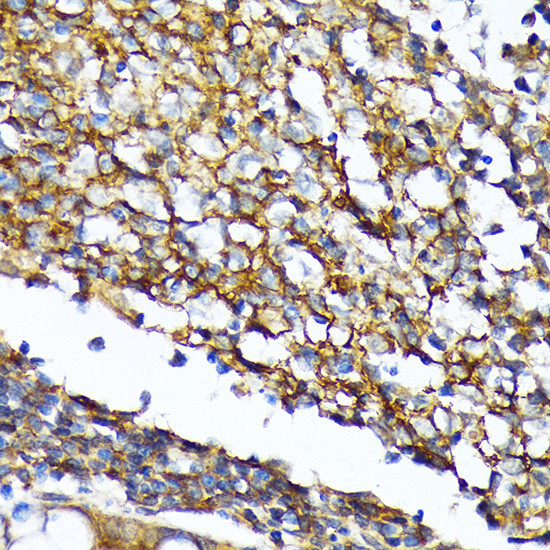 CD82 Antibody in Immunohistochemistry (Paraffin) (IHC (P))